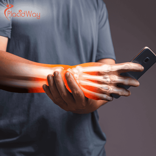 Carpal Tunnel Surgery in Turkey: Key Information for Canadian Patients